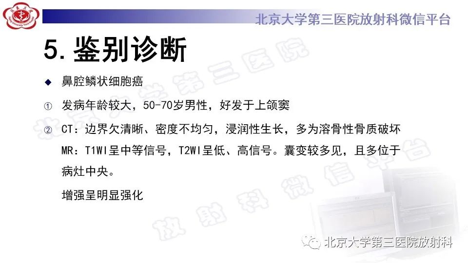 影像PPT - 【PPT】鼻腔鼻窦恶性黑色素瘤-24