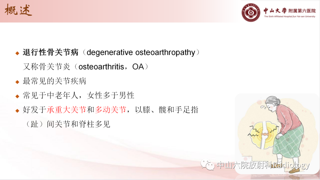 影像PPT - 【PPT】退行性骨关节病-3