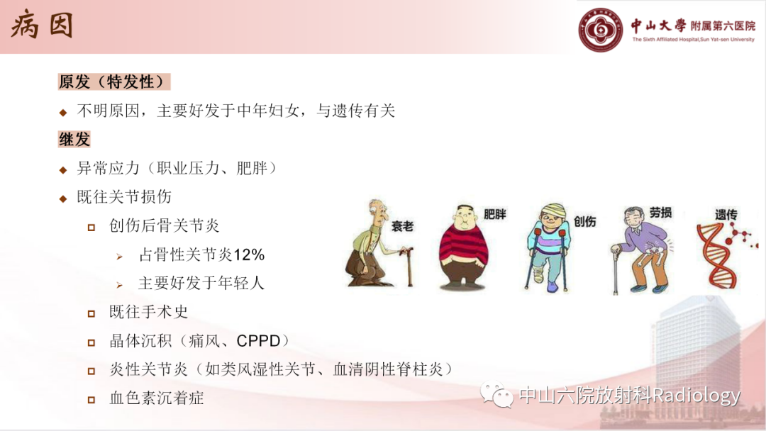 影像PPT - 【PPT】退行性骨关节病-4