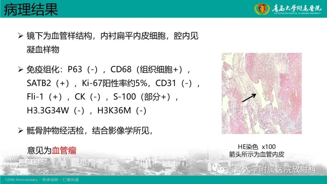 影像PPT - 【病例】骶椎椎体血管瘤1例CT及MR影像-11