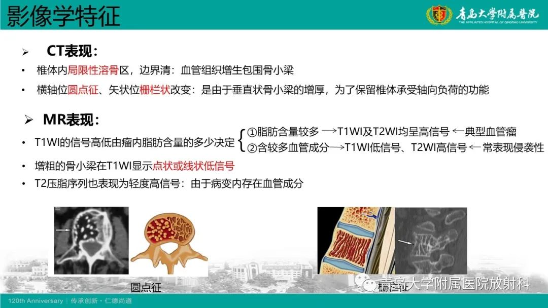 影像PPT - 【病例】骶椎椎体血管瘤1例CT及MR影像-16