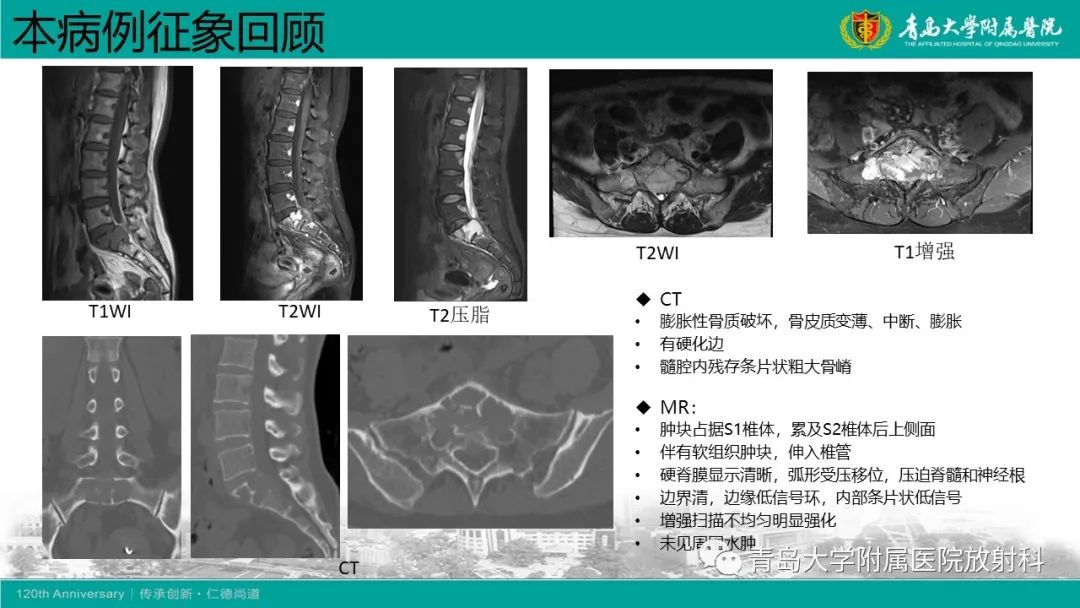 影像PPT - 【病例】骶椎椎体血管瘤1例CT及MR影像-19