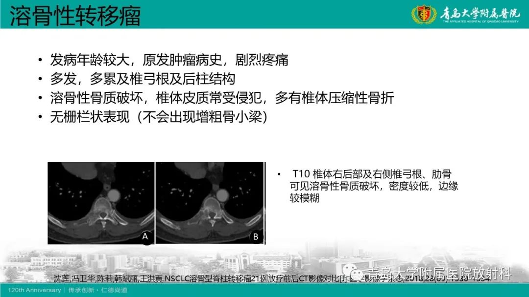 影像PPT - 【病例】骶椎椎体血管瘤1例CT及MR影像-22