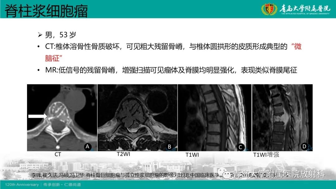 影像PPT - 【病例】骶椎椎体血管瘤1例CT及MR影像-24