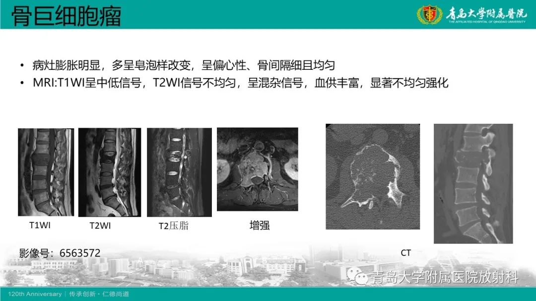 影像PPT - 【病例】骶椎椎体血管瘤1例CT及MR影像-25