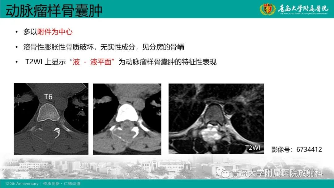 影像PPT - 【病例】骶椎椎体血管瘤1例CT及MR影像-26