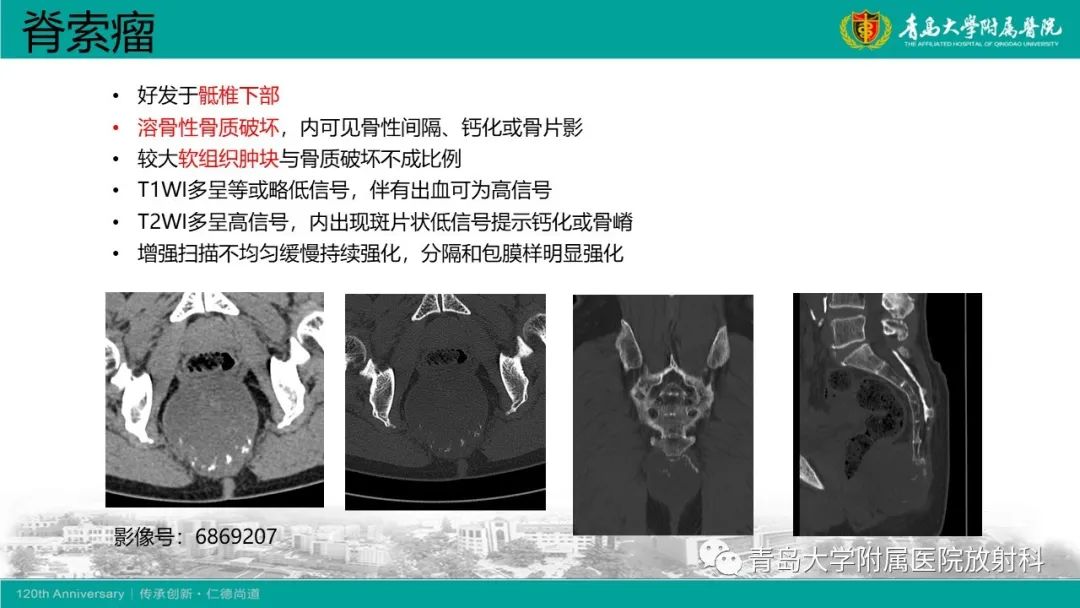 影像PPT - 【病例】骶椎椎体血管瘤1例CT及MR影像-27