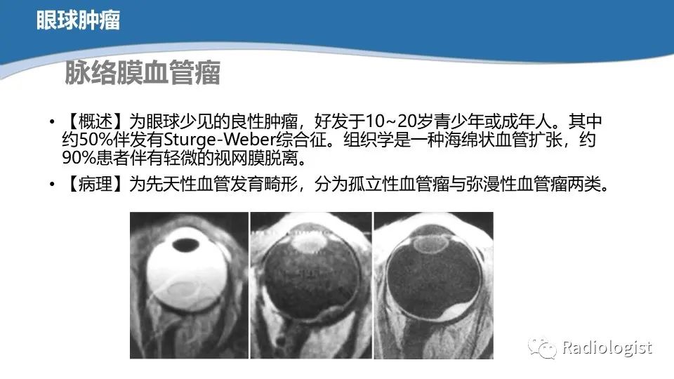 影像PPT - 【PPT】眼部疾病CT、MRI影像表现-46