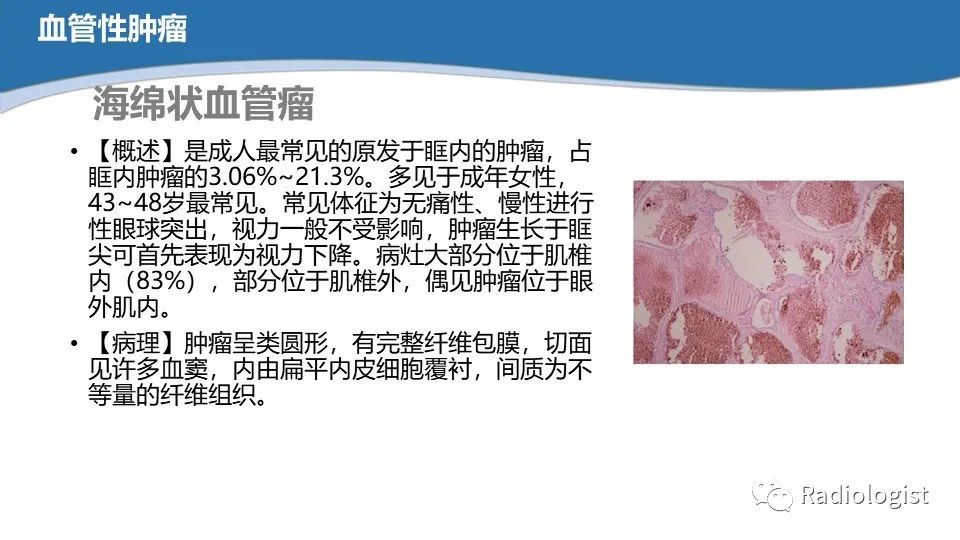 影像PPT - 【PPT】眼部疾病CT、MRI影像表现-58