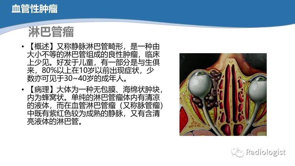 影像PPT - 【PPT】眼部疾病CT、MRI影像表现-63