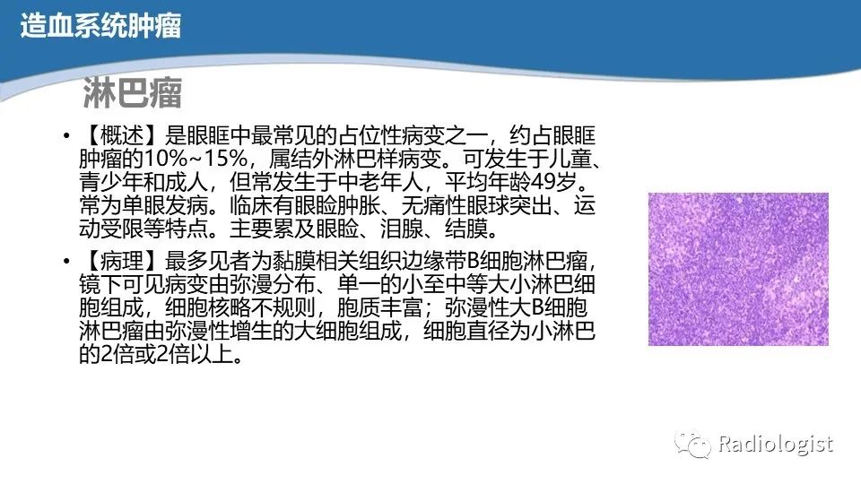 影像PPT - 【PPT】眼部疾病CT、MRI影像表现-65