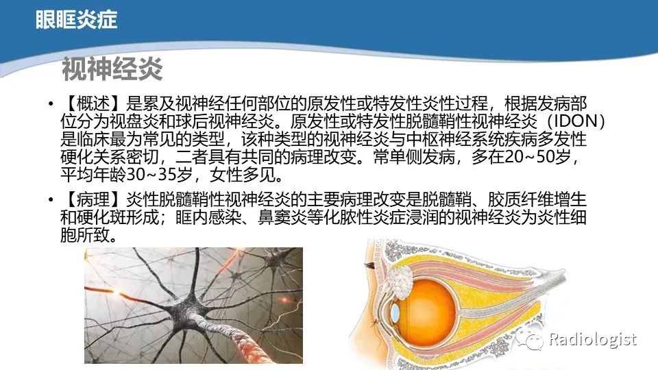 影像PPT - 【PPT】眼部疾病CT、MRI影像表现-88