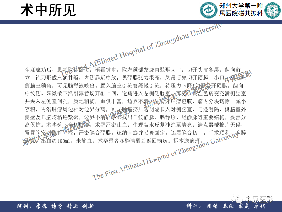影像PPT - 【病例】侧脑室胶质母细胞瘤1例MR影像-12