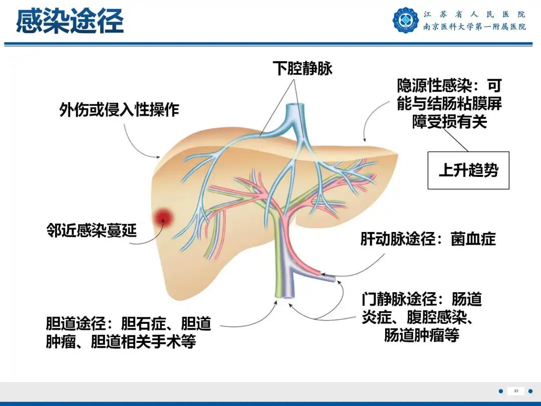 影像PPT - 【PPT】细菌性肝脓肿-24