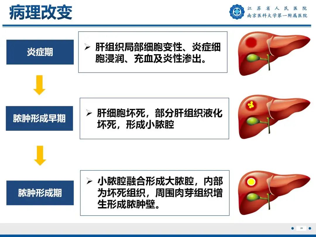 影像PPT - 【PPT】细菌性肝脓肿-25