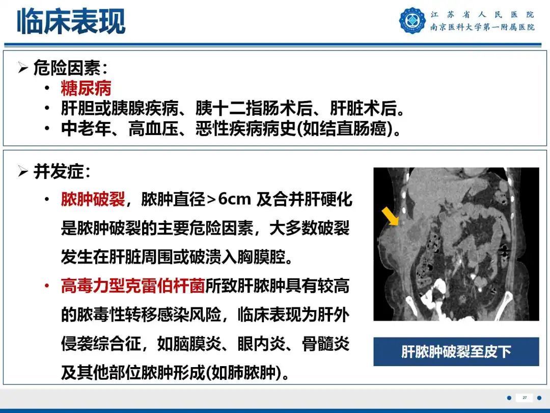 影像PPT - 【PPT】细菌性肝脓肿-28