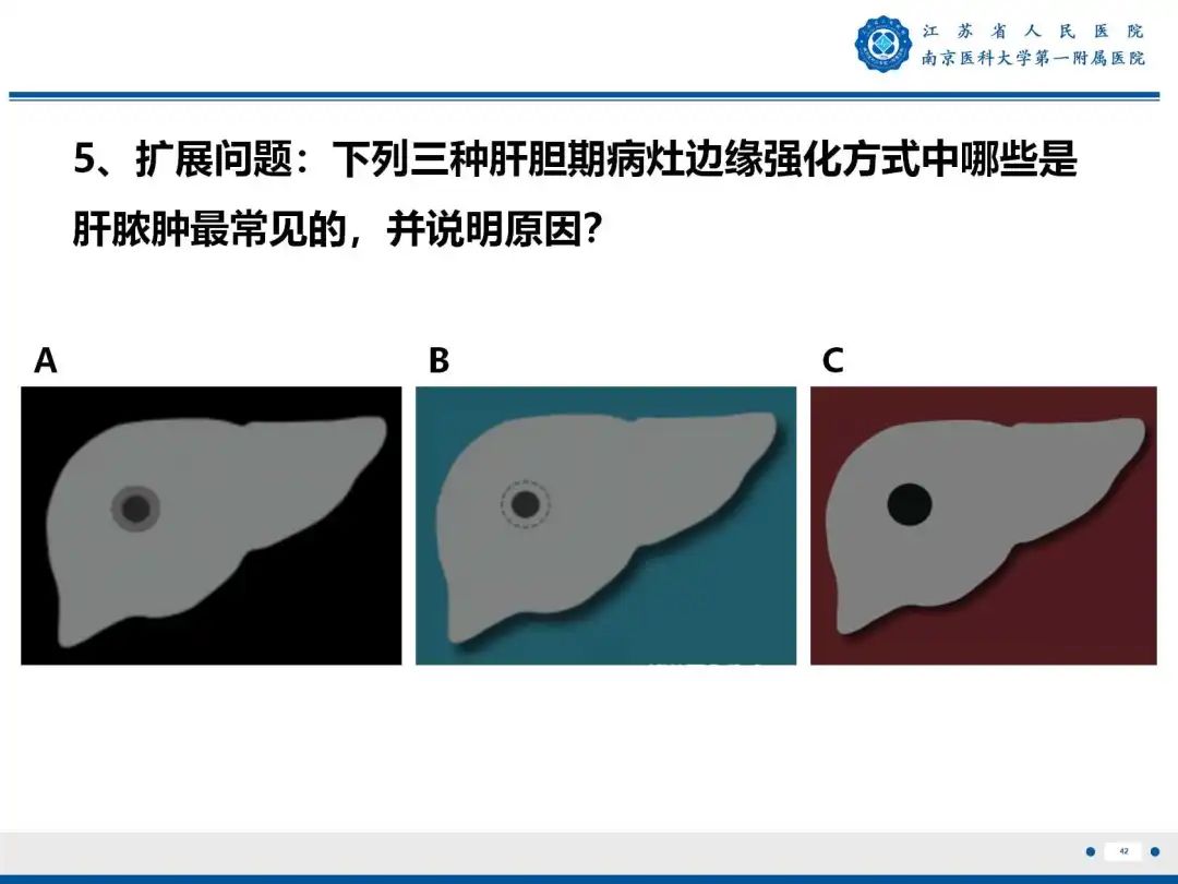 影像PPT - 【PPT】细菌性肝脓肿-43