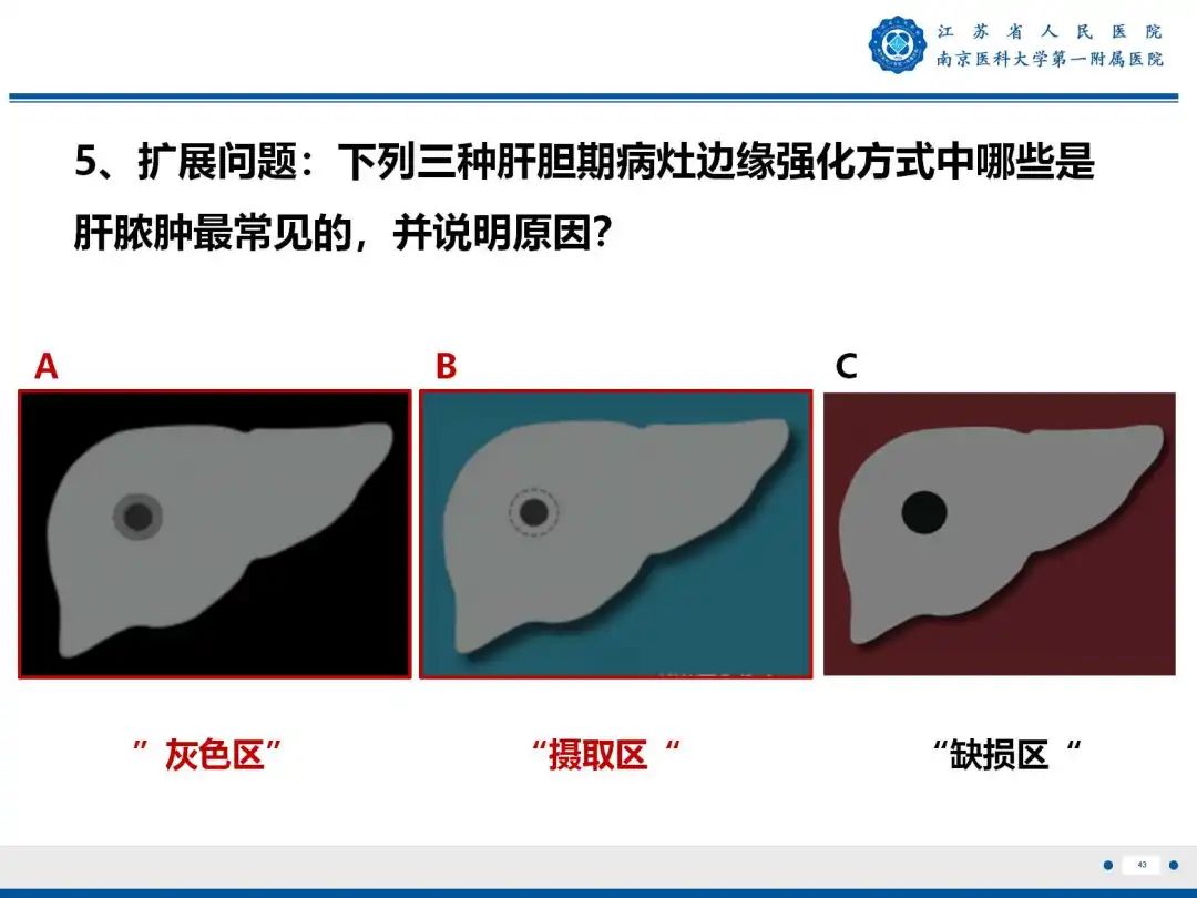 影像PPT - 【PPT】细菌性肝脓肿-44