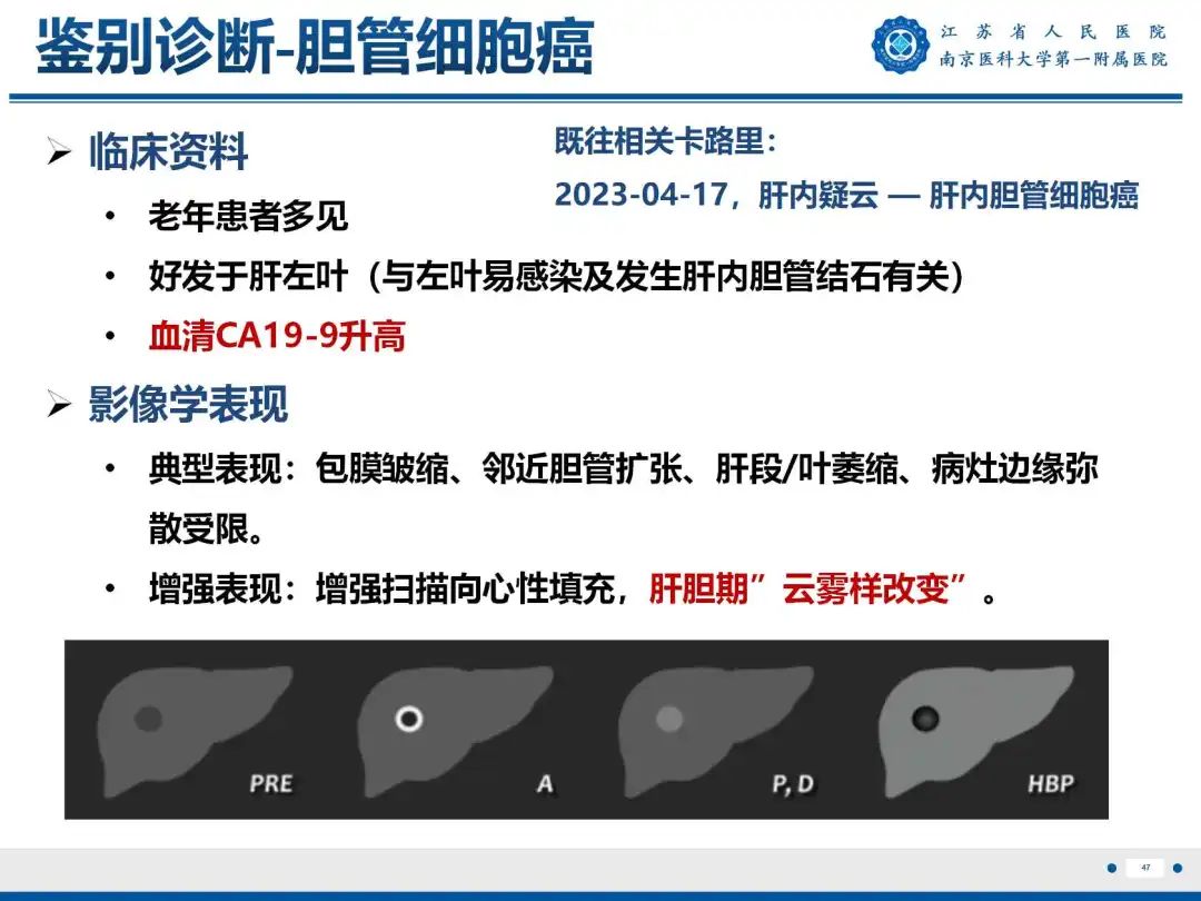 影像PPT - 【PPT】细菌性肝脓肿-48