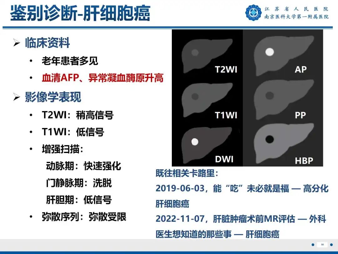 影像PPT - 【PPT】细菌性肝脓肿-51