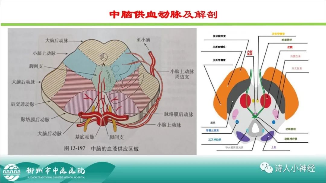 影像PPT - 【PPT】各种脑干梗死综合征临床解剖及影像-4