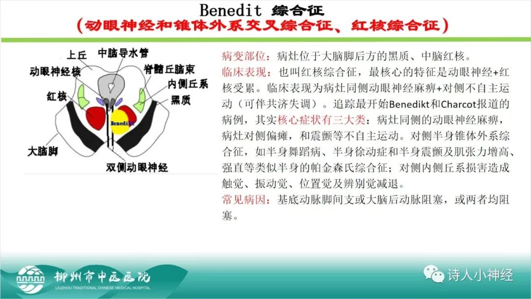 影像PPT - 【PPT】各种脑干梗死综合征临床解剖及影像-17