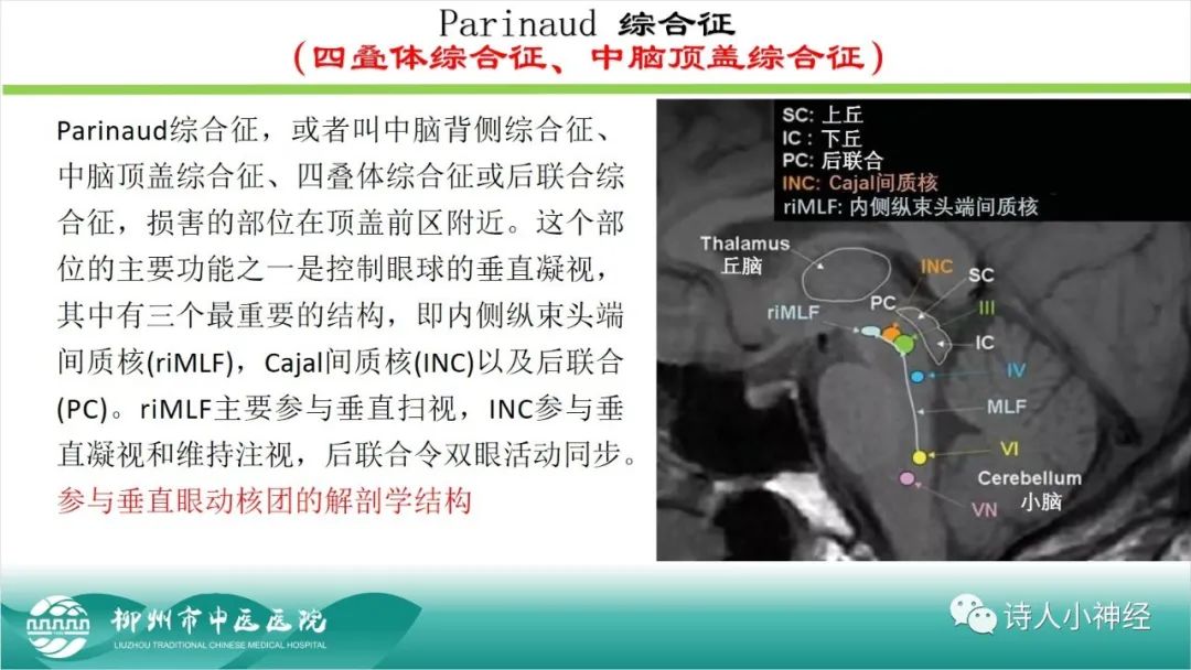 影像PPT - 【PPT】各种脑干梗死综合征临床解剖及影像-26