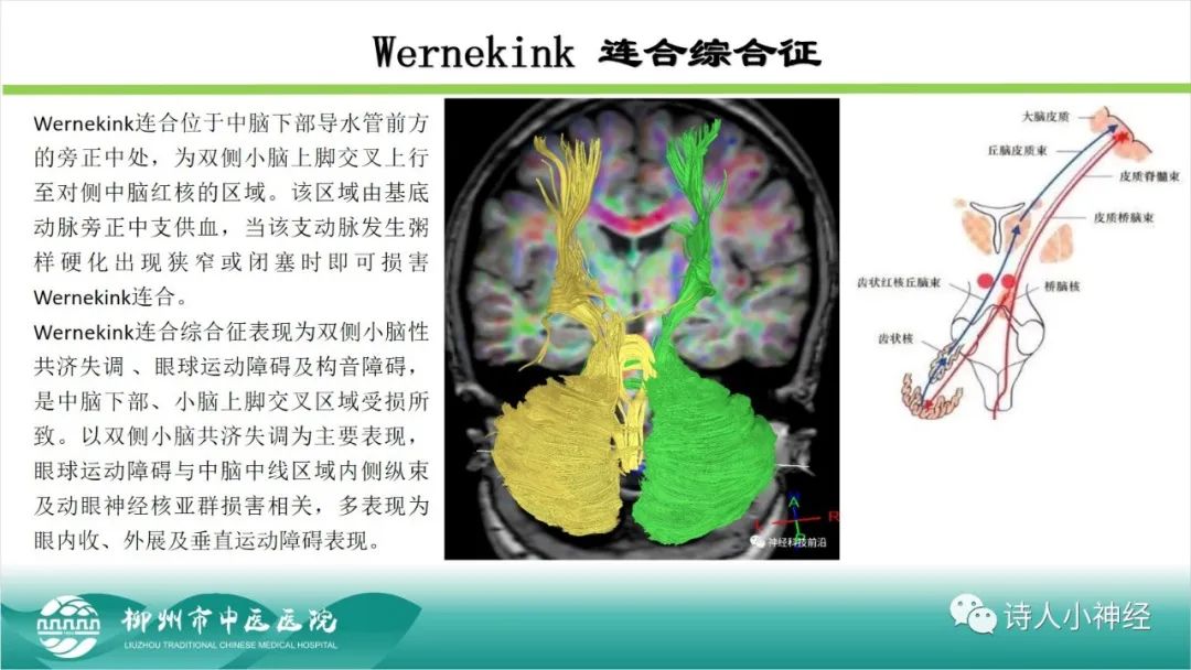 影像PPT - 【PPT】各种脑干梗死综合征临床解剖及影像-32
