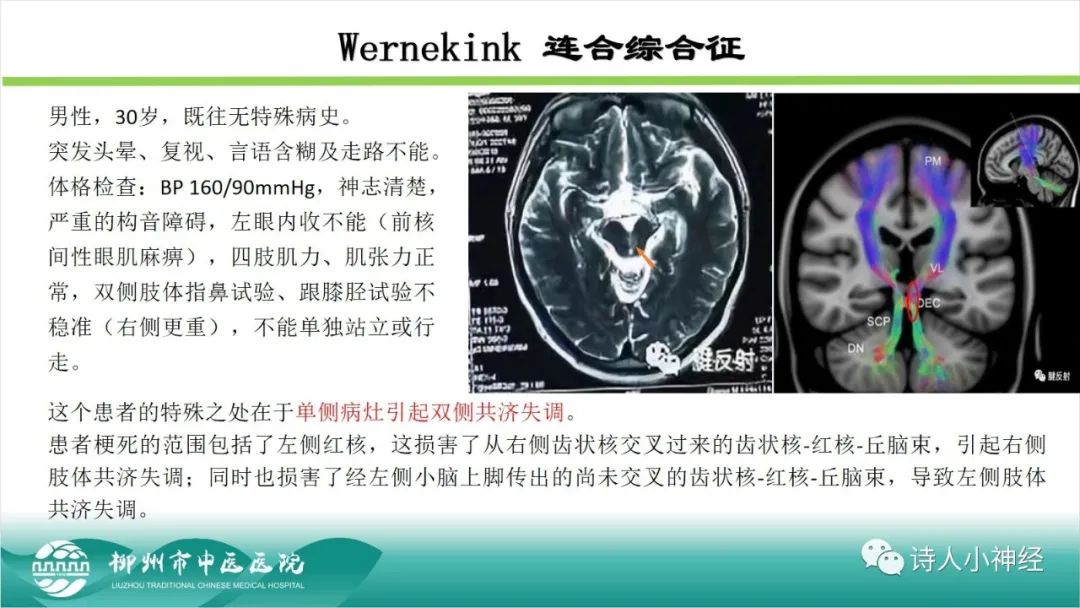 影像PPT - 【PPT】各种脑干梗死综合征临床解剖及影像-35