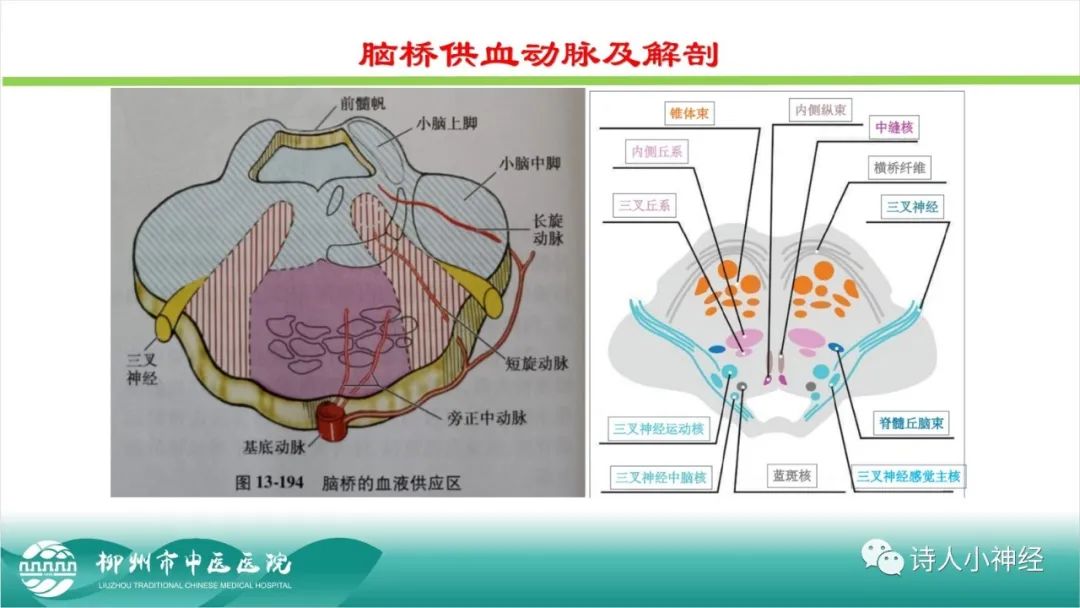 影像PPT - 【PPT】各种脑干梗死综合征临床解剖及影像-37