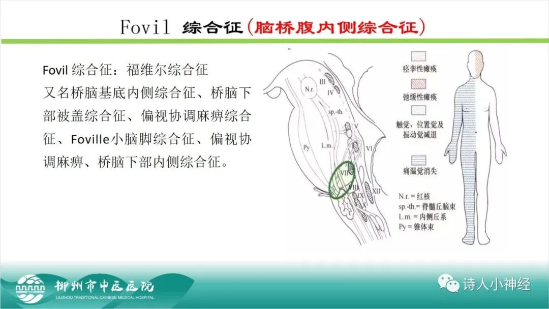 影像PPT - 【PPT】各种脑干梗死综合征临床解剖及影像-51