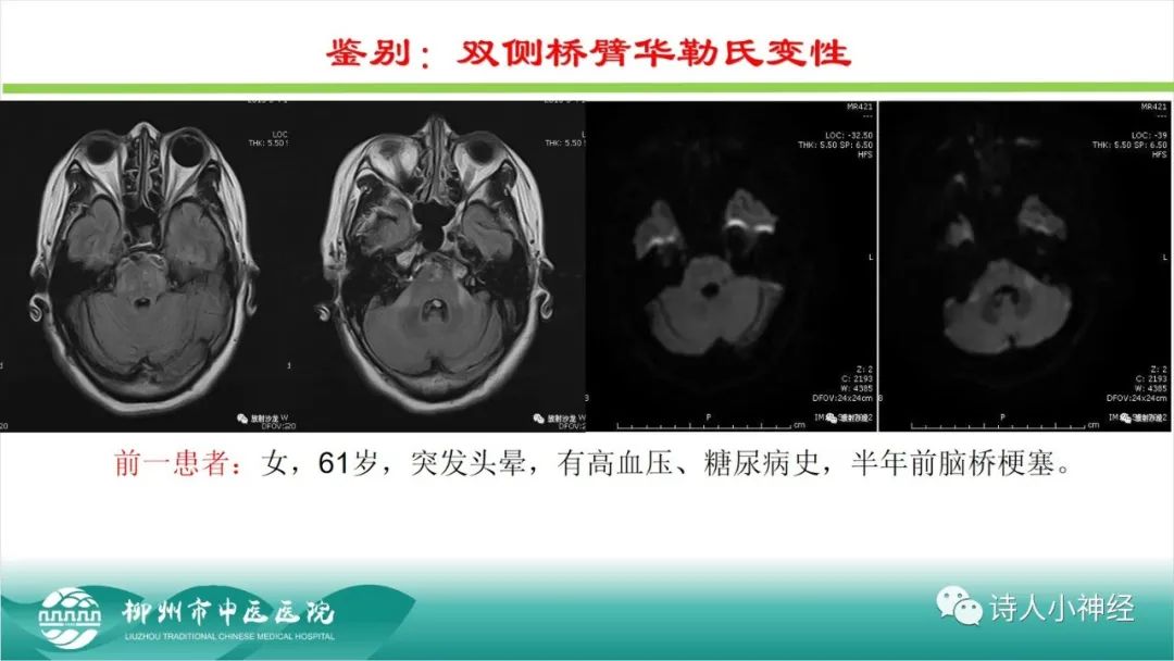 影像PPT - 【PPT】各种脑干梗死综合征临床解剖及影像-76