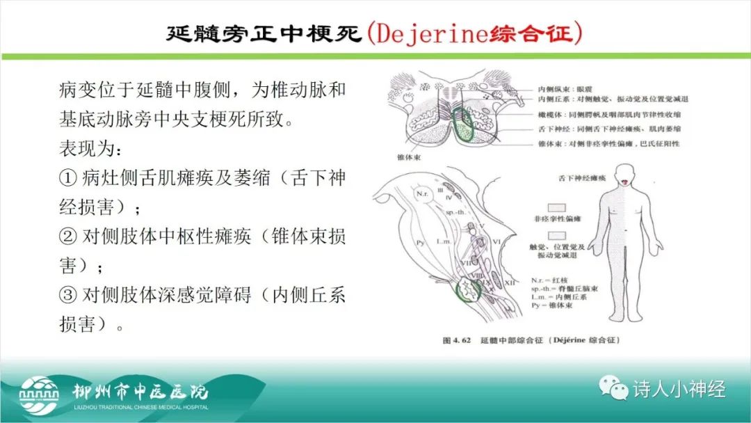 影像PPT - 【PPT】各种脑干梗死综合征临床解剖及影像-81