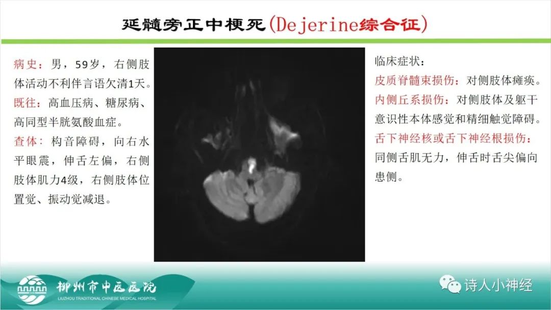影像PPT - 【PPT】各种脑干梗死综合征临床解剖及影像-85