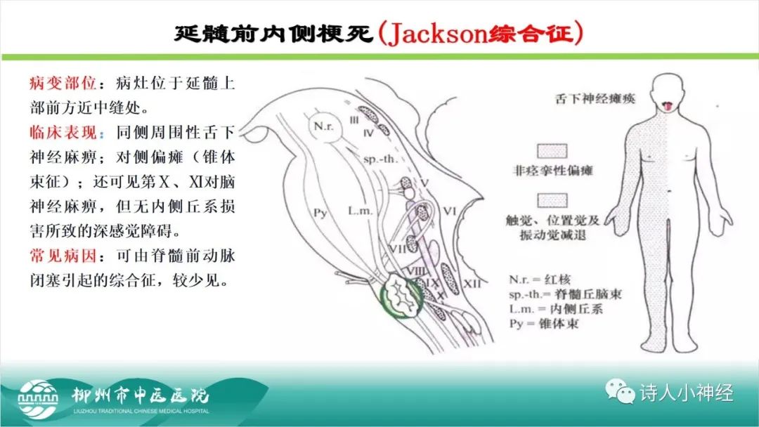 影像PPT - 【PPT】各种脑干梗死综合征临床解剖及影像-87