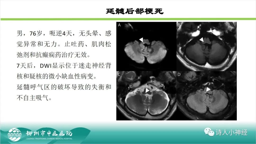 影像PPT - 【PPT】各种脑干梗死综合征临床解剖及影像-104