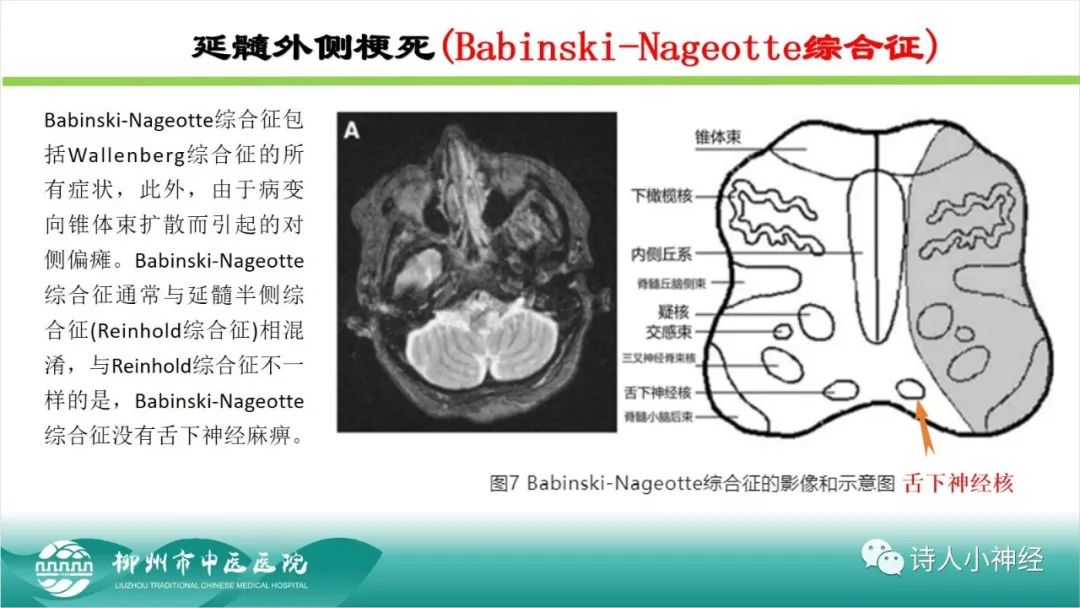 影像PPT - 【PPT】各种脑干梗死综合征临床解剖及影像-107