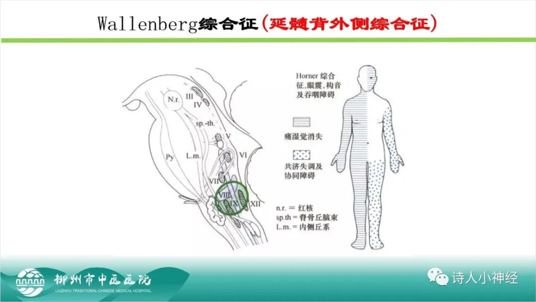 影像PPT - 【PPT】各种脑干梗死综合征临床解剖及影像-113