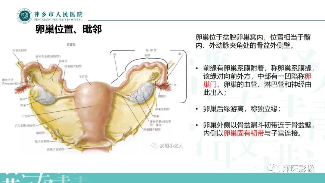 影像PPT - 【PPT】卵巢囊腺瘤诊断与鉴别诊断-5