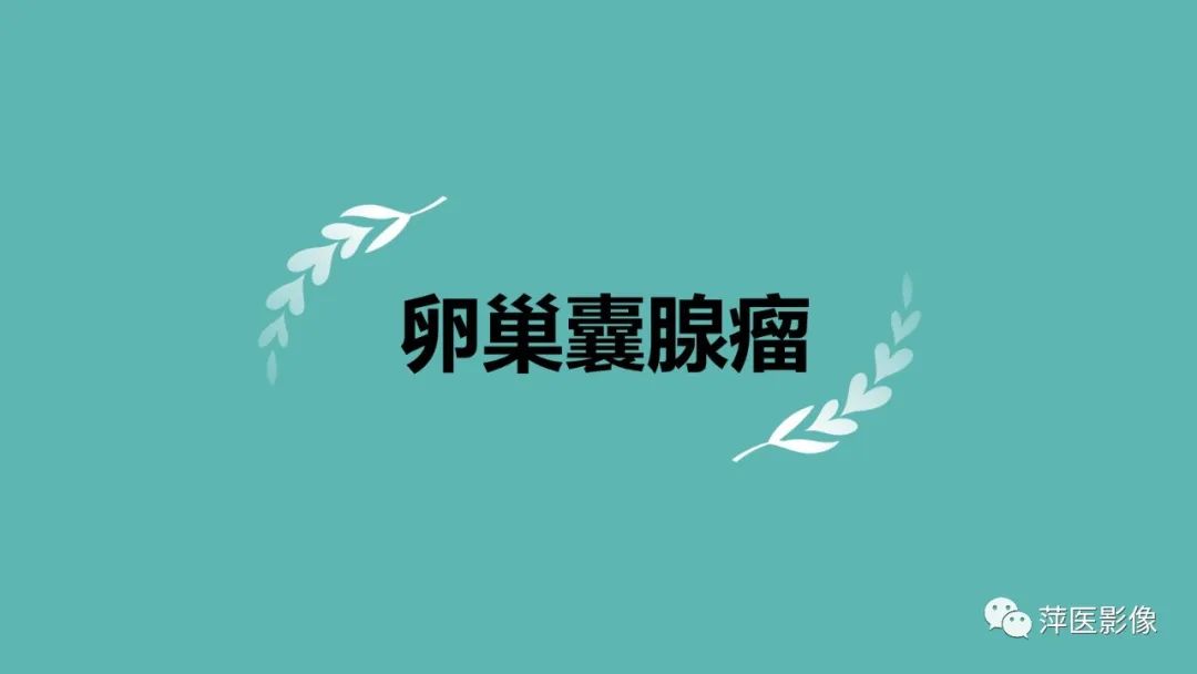 影像PPT - 【PPT】卵巢囊腺瘤诊断与鉴别诊断-8