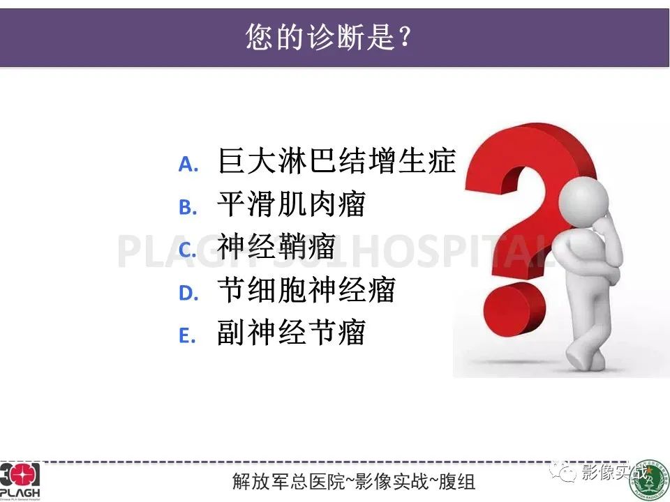 影像PPT - 【病例】腹膜后神经鞘瘤1例CT及MR影像-17