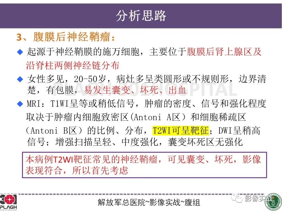 影像PPT - 【病例】腹膜后神经鞘瘤1例CT及MR影像-23