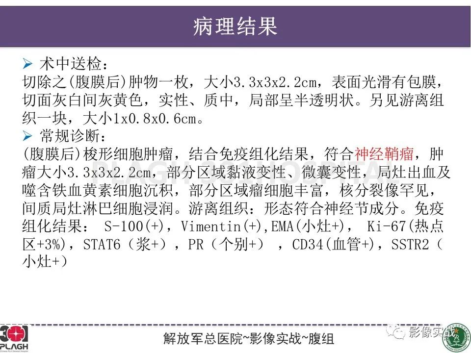 影像PPT - 【病例】腹膜后神经鞘瘤1例CT及MR影像-26