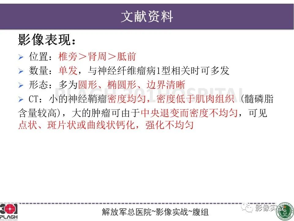 影像PPT - 【病例】腹膜后神经鞘瘤1例CT及MR影像-30