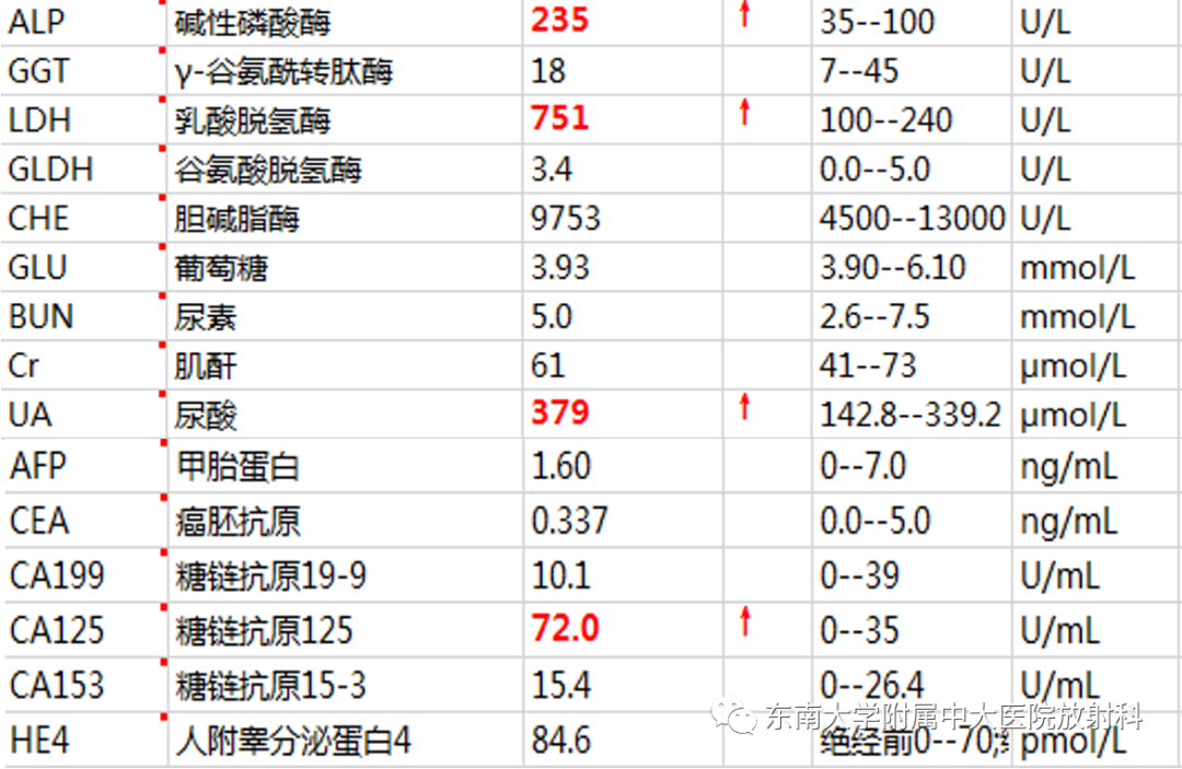 影像PPT - 【PPT】卵巢无性细胞瘤-1