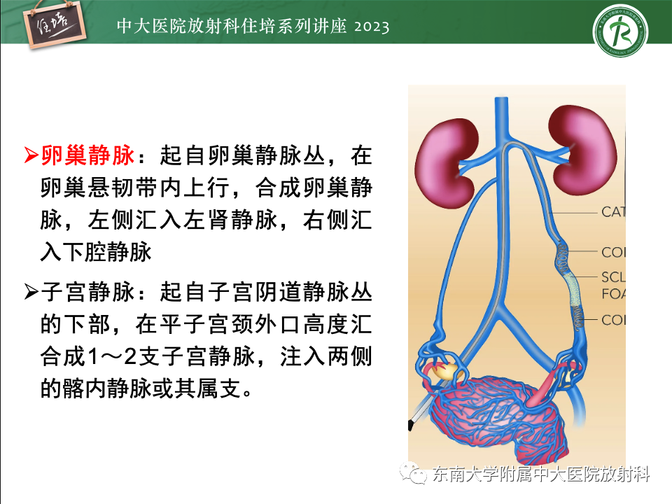 影像PPT - 【PPT】卵巢扭转诊断与鉴别诊断-5