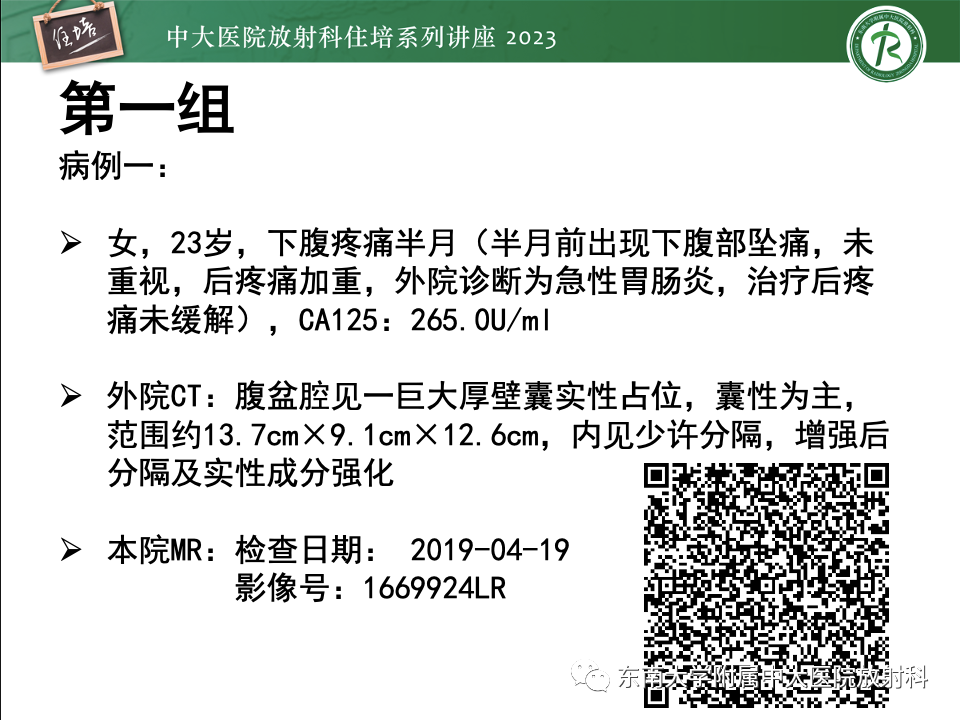 影像PPT - 【PPT】卵巢扭转诊断与鉴别诊断-12
