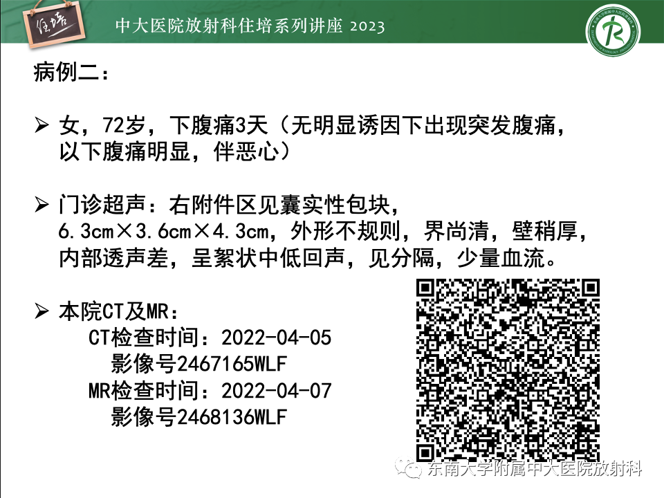 影像PPT - 【PPT】卵巢扭转诊断与鉴别诊断-15