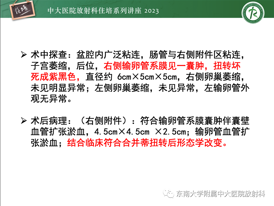 影像PPT - 【PPT】卵巢扭转诊断与鉴别诊断-18