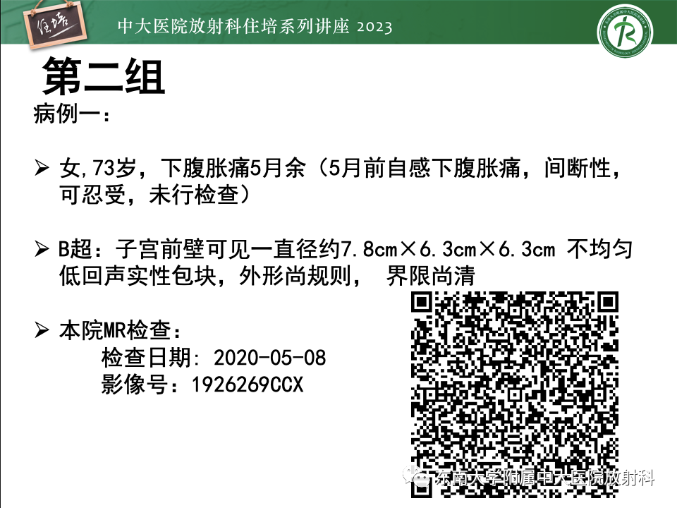 影像PPT - 【PPT】卵巢扭转诊断与鉴别诊断-19